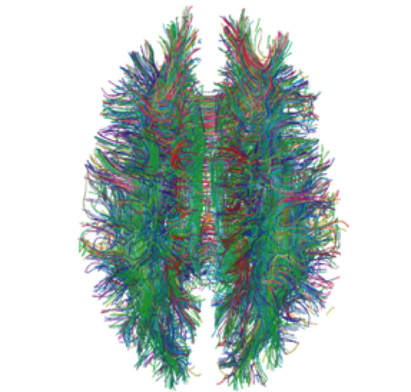 Credit: Gigandet X, Hagmann P, Kurant M, Cammoun L, Meuli R, et al. Estimating the Confidence Level of White Matter Connections Obtained with MRI Tractography. PLoS ONE. 3(12) (2008).