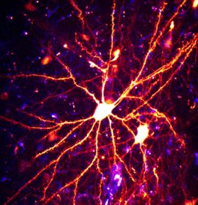 New technologies can enable researchers to better understand how complex behaviors emerge from the activity of brain circuits. This image shows nerve cells in the brain of a songbird that are associated with learning and producing birdsongs. (Credit: Vamsi Daliparthi and Todd Roberts, Department of Neuroscience, UT Southwestern Medical Center)