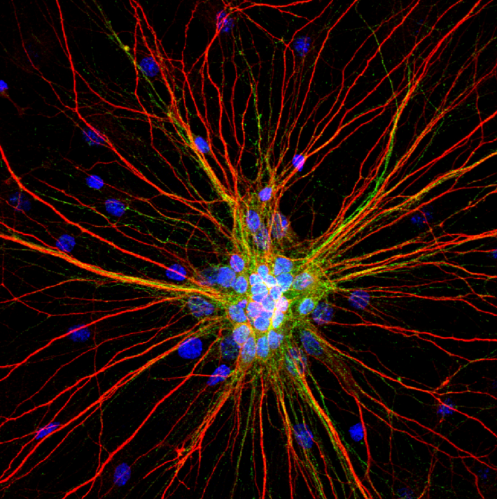 flourescent imae of a brain cell