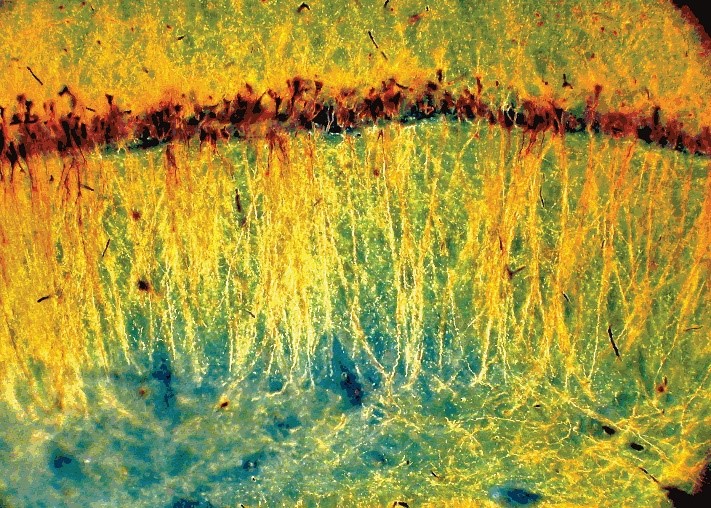 abstract image of a neuron