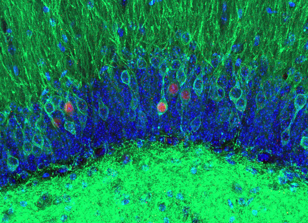 A cluster of neurons in a mouse hippocampus colored green and blue with a few 'active' neurons colored red.