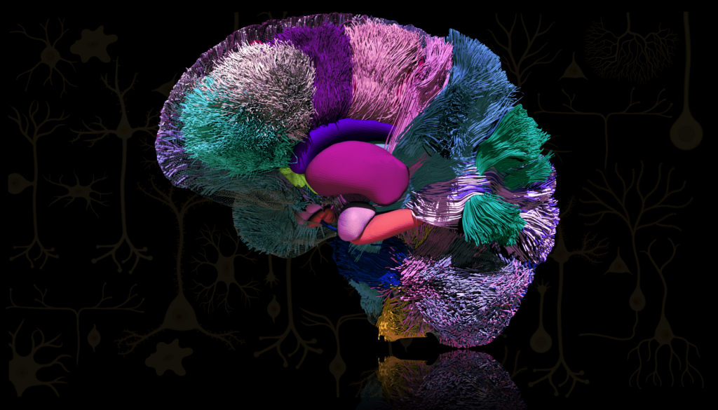 A colorful image in green, purple, blue, pink, and yellow created using diffusion MRI tractography shows brain activity on a black background.