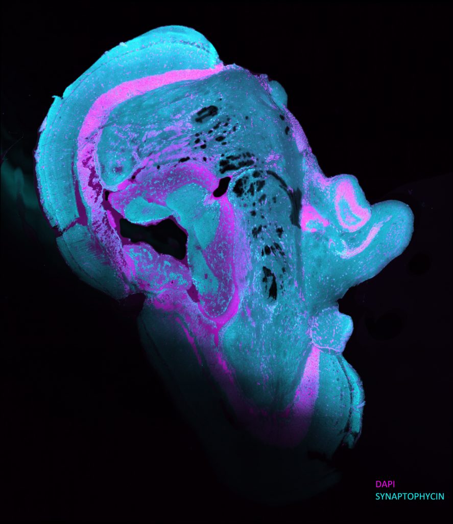 An image of a zebrafish brain tissue section with blue and purple DAPI staining to show antibody optimization. 