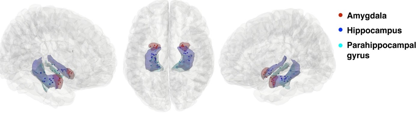 three images of brain with colored in sections of the brain