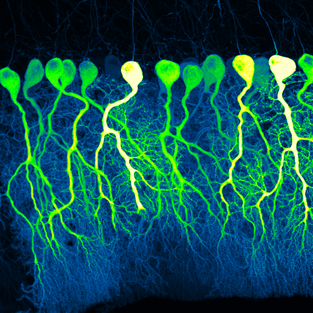 A confocal image of sparse GCaMP6f-expressing Purkinje cells (green) in mouse cerebellum.
