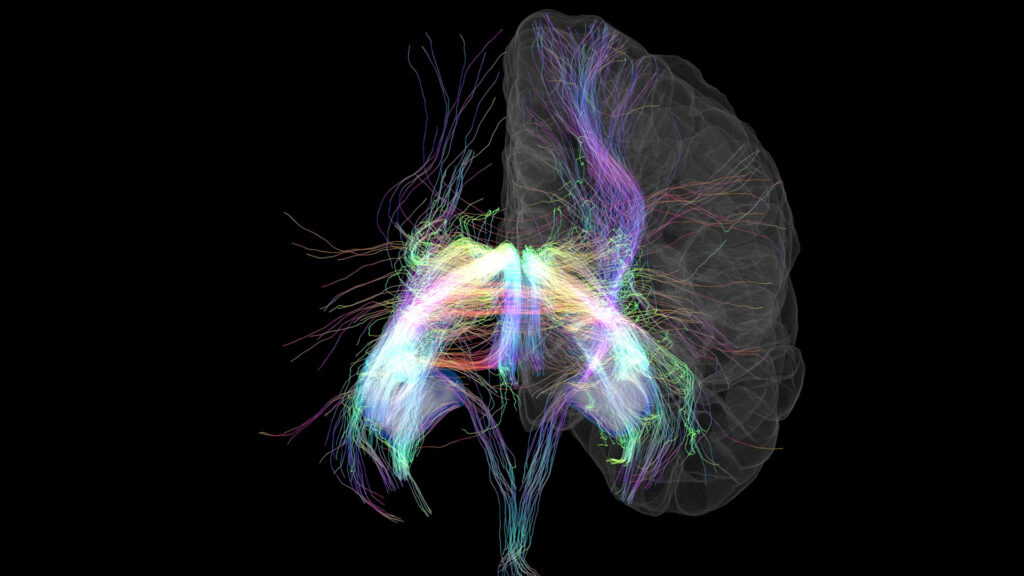 A rendering of MRI data depicts in multiple colors combining cortical surface and hippocampal segmentations.