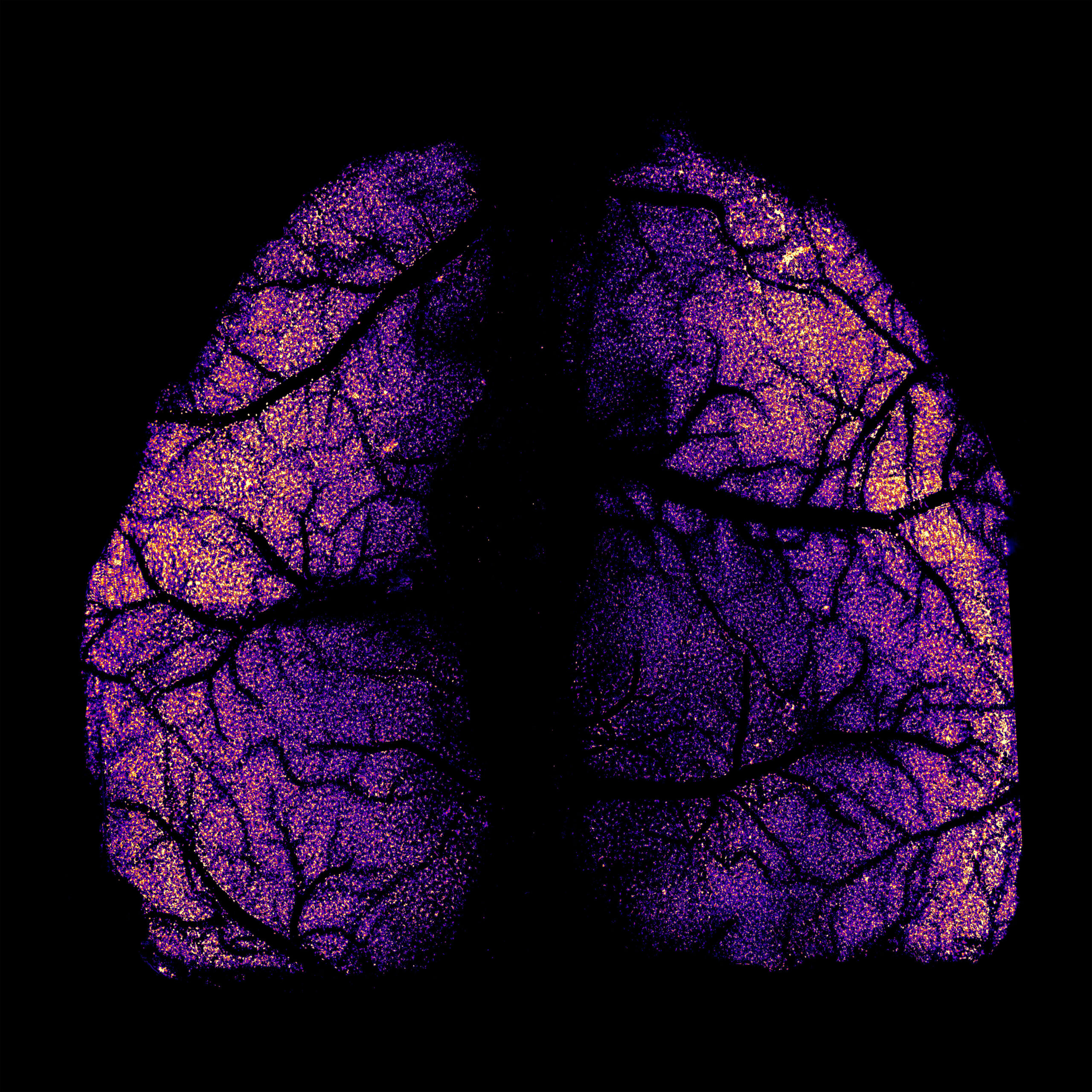 Image of lungs