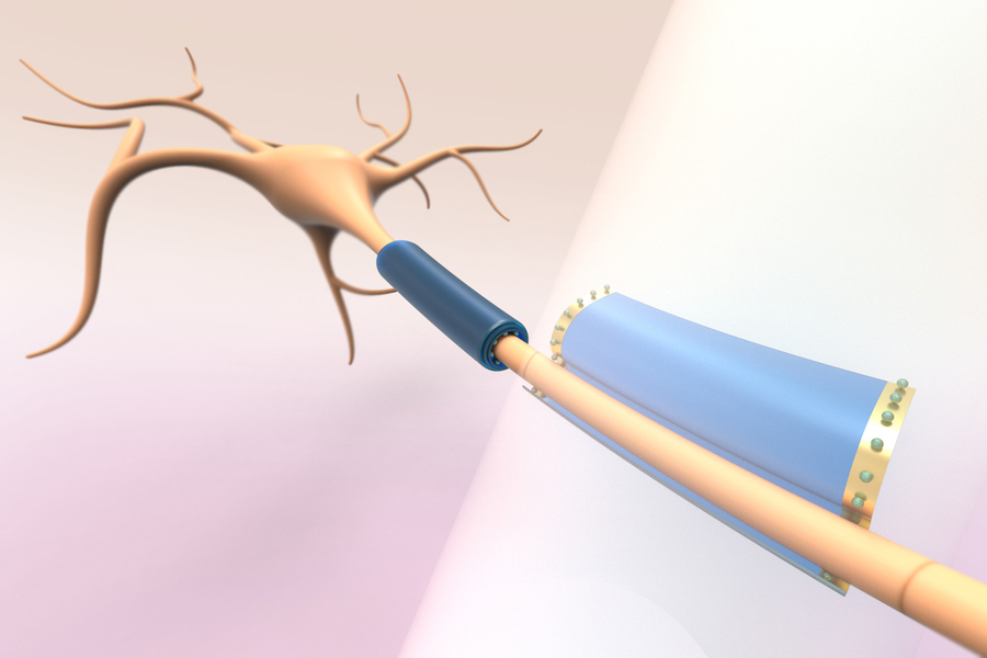 Artistic rendition of a neuron with the researchers' thin device wrapping around the axon part of the neuron.
